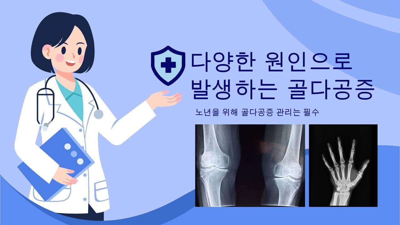 골다공증 관리