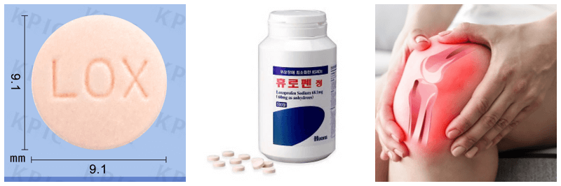 휴로펜정, 무릎 관절염 사진