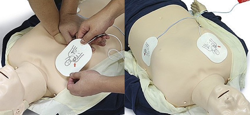 심장충격기사용방법