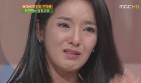 눈 성형 부작용