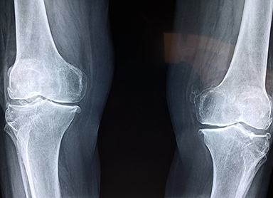 종근당 이모튼 캡슐 가격 부작용