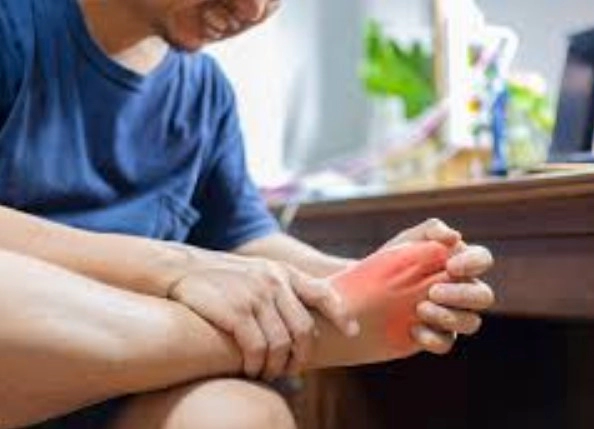 통풍에 안좋은 음식 정리