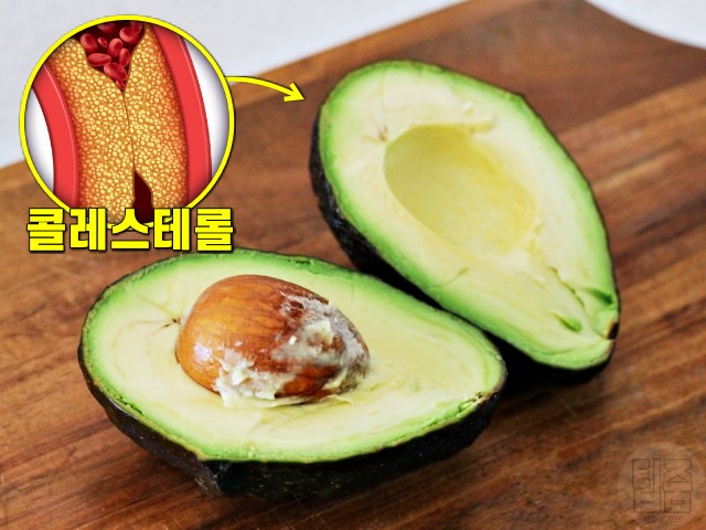 아보카도 효능, 콜레스테롤 낮추는 음식, 심장에 좋은 음식, 팁줌