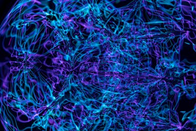 후두신경통 혈자리