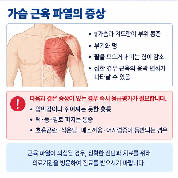 가슴 근육 파열의 앞가슴 겨드랑이 통증 멍 밀기 힘 저하와 응급 흉통 구분 신호를 정리한 이미지