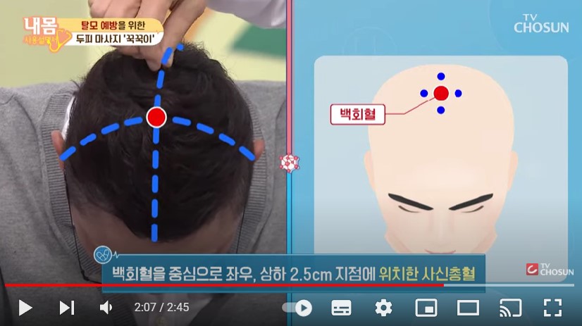 탈모 예방 혈자리