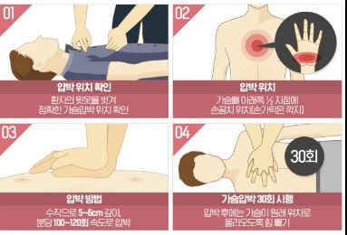 심폐소생술