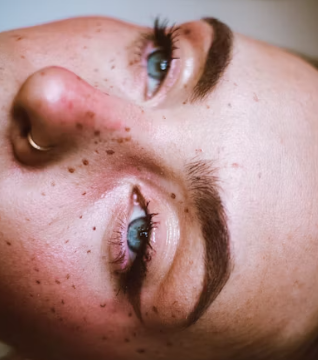 눈썹 이식 비용 가격 부작용