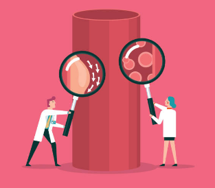 고지혈증 증상&amp;#44; 고지혈증에 좋은 음식&amp;#44; 고지혈증 수치 총정리 (2024ver)