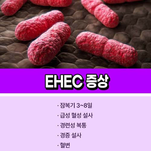 장출혈성_대장균_감염증_증상