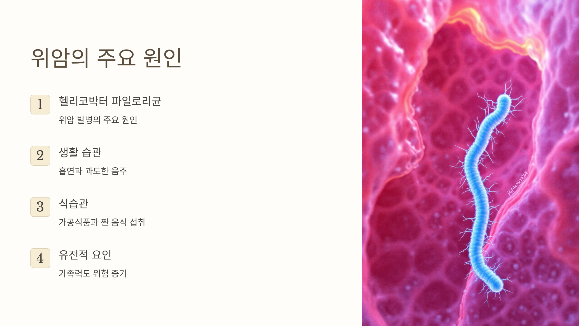 위암의 주요 원인