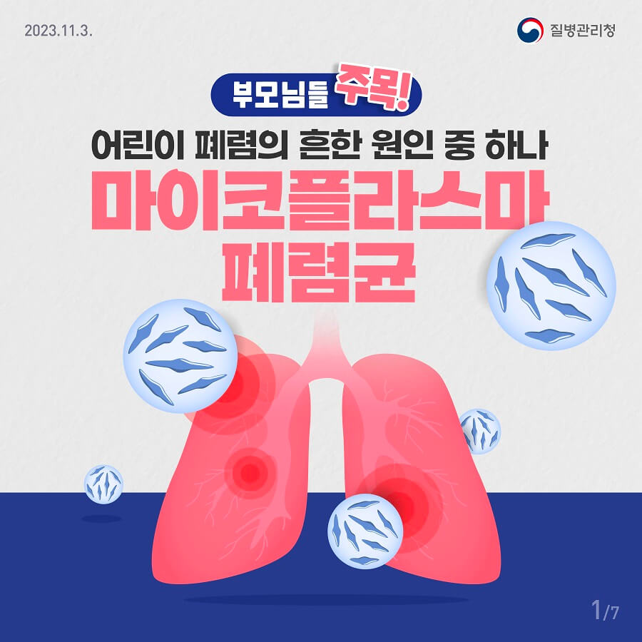 마이코플라스마 폐렴