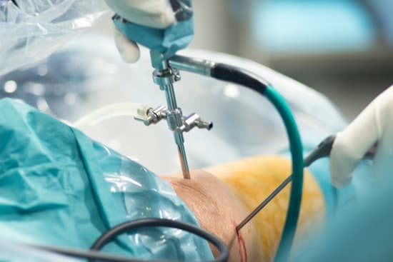 자가 연골 이식술