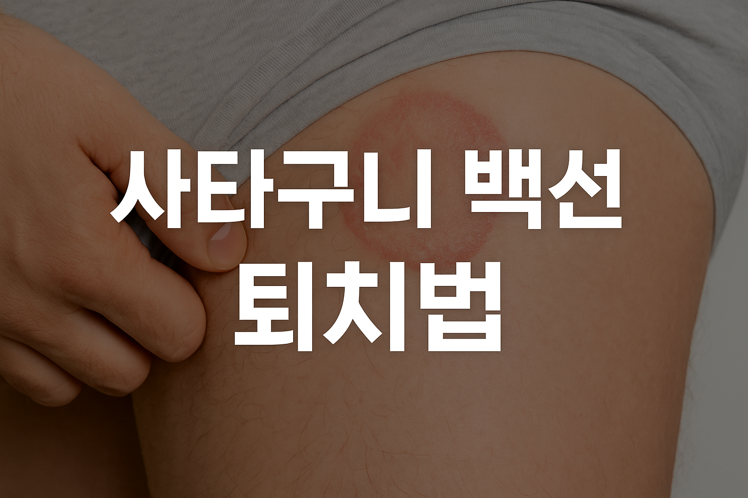 사타구니 백선 퇴치법 썸네일 이미지