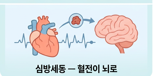 심방세동이란 무엇이고 왜 위험한가