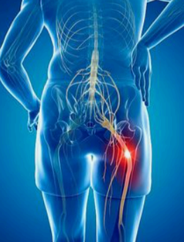 대상포진 증상 사진