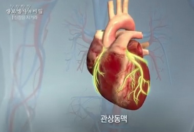 관상동맥
