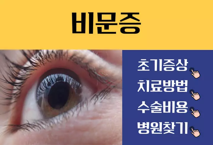 비문증 치료방법 완치방법