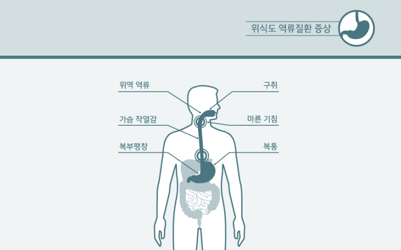 역류성 식도염 목 통증&amp;#44; 삼킬 때 불편한 이유