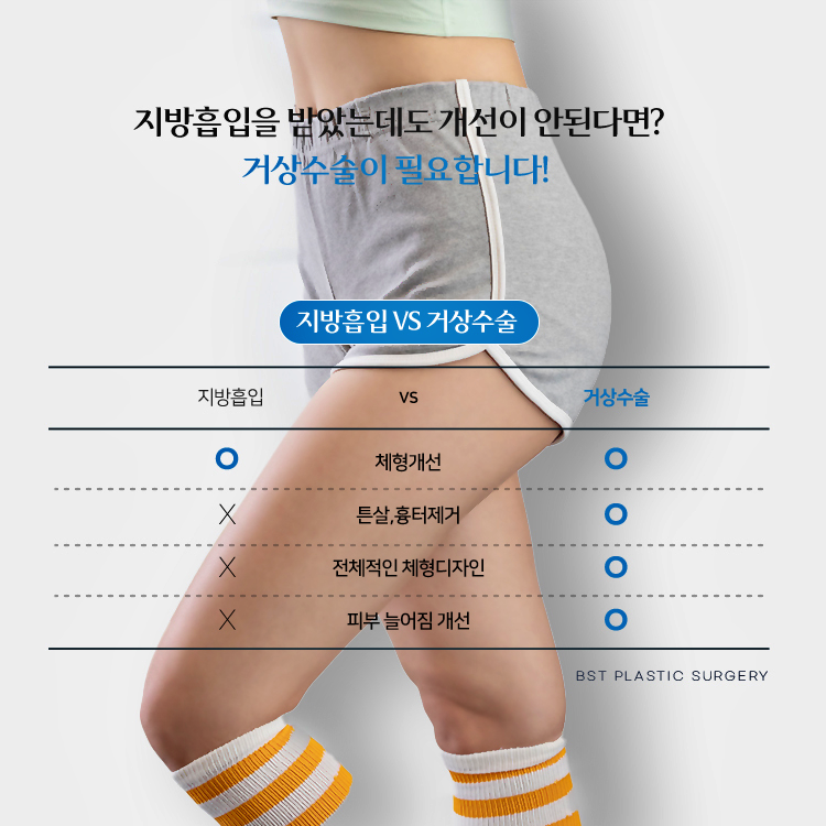 거상수술은 체형개선, 튼살과 흉터제거, 전체적인 체형디자인, 피부 늘어짐을 개선할 수 있습니다.