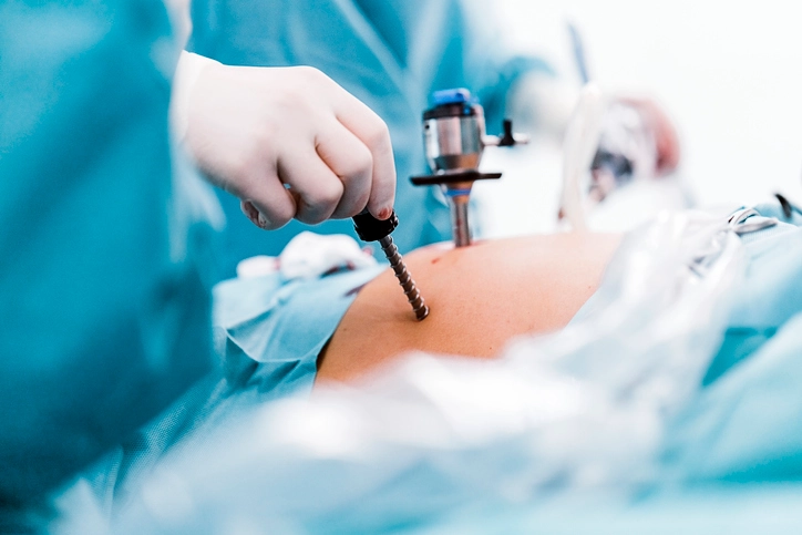 암 위험을 절반으로 줄일 수 있는 이 수술은 Weight Loss Surgery Could Cut Cancer Risk in Half Over Time