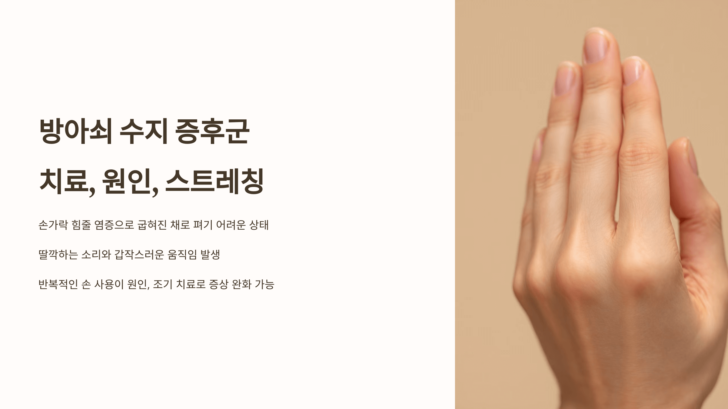 방아쇠 수지 증후군 관련된 사진입니다.