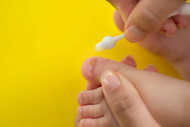 발톱을-소독중인-모습