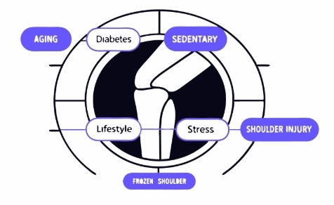 오십견 원인과 의심증상