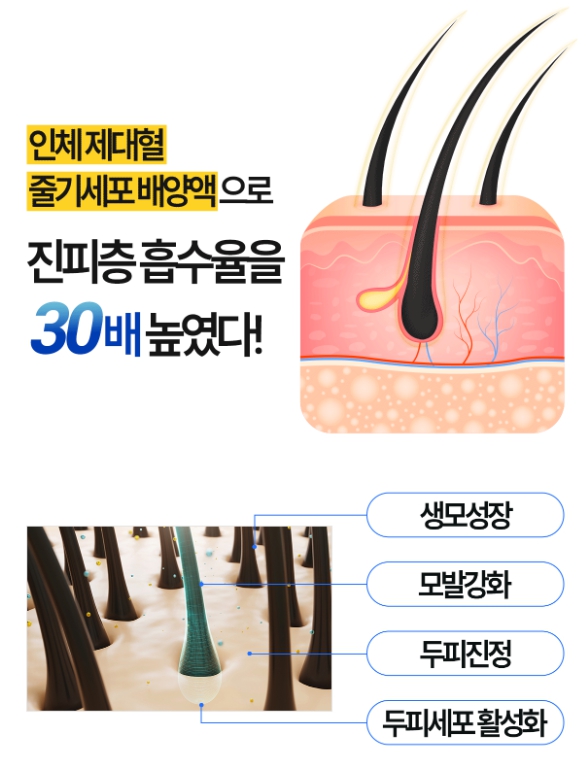 줄기세포-탈모치료제-리맨틱2