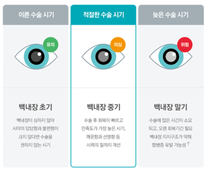 노안 검사