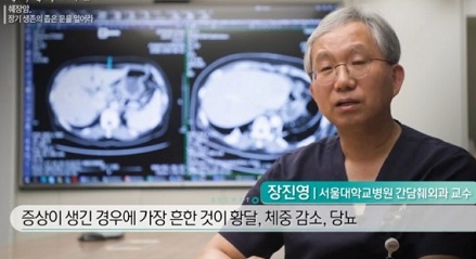 췌장암명의