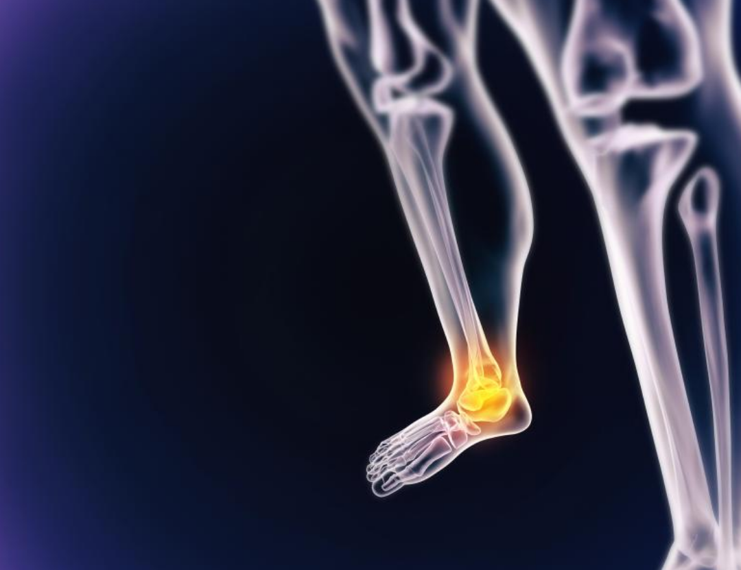 발목의 염증이 생긴 그림