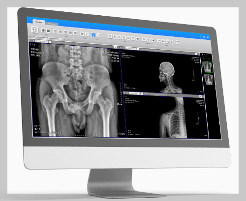 영상 솔루션 - ExamVue mini PACS