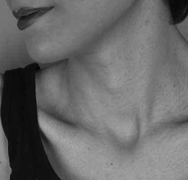 갑상선 기능 저하증 증상 원인 치료법