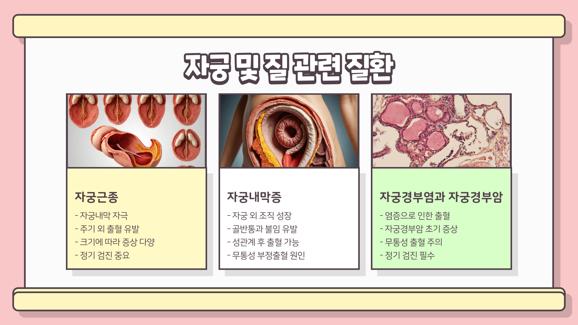 부정출혈 원인과 치료