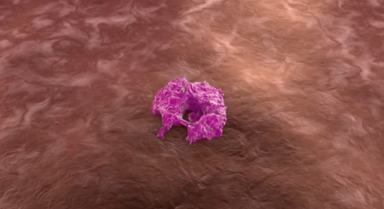 위내시경 조직검사 하는이유