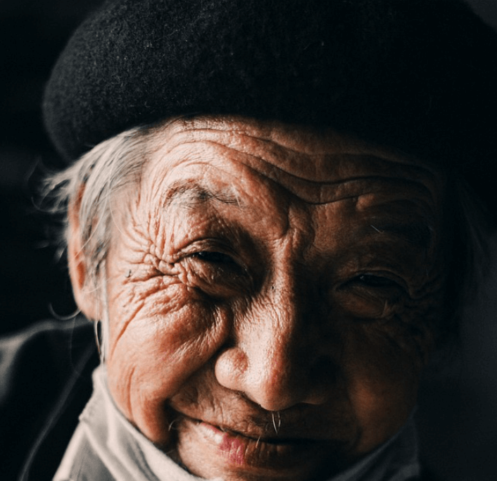 퇴행성관절염 원인 증상 치료방법