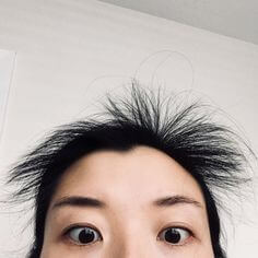 머리카락이-나기-시작하는