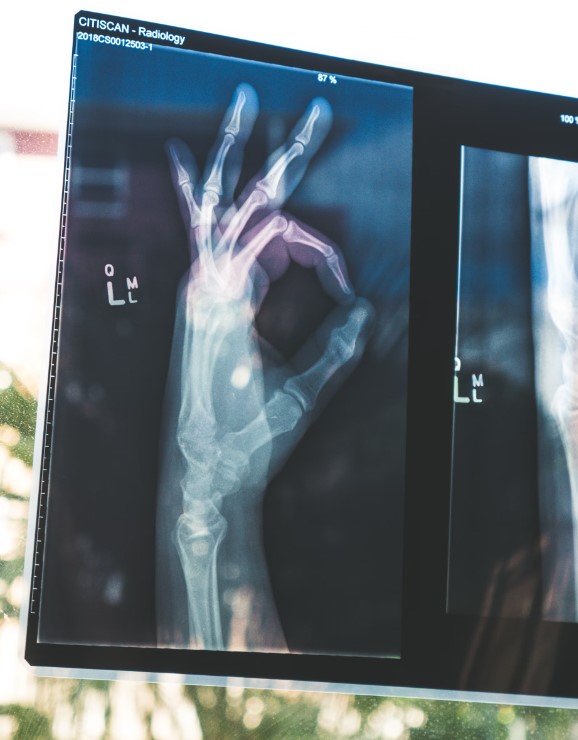 뼈에 좋은음식 영양제 약초 운동