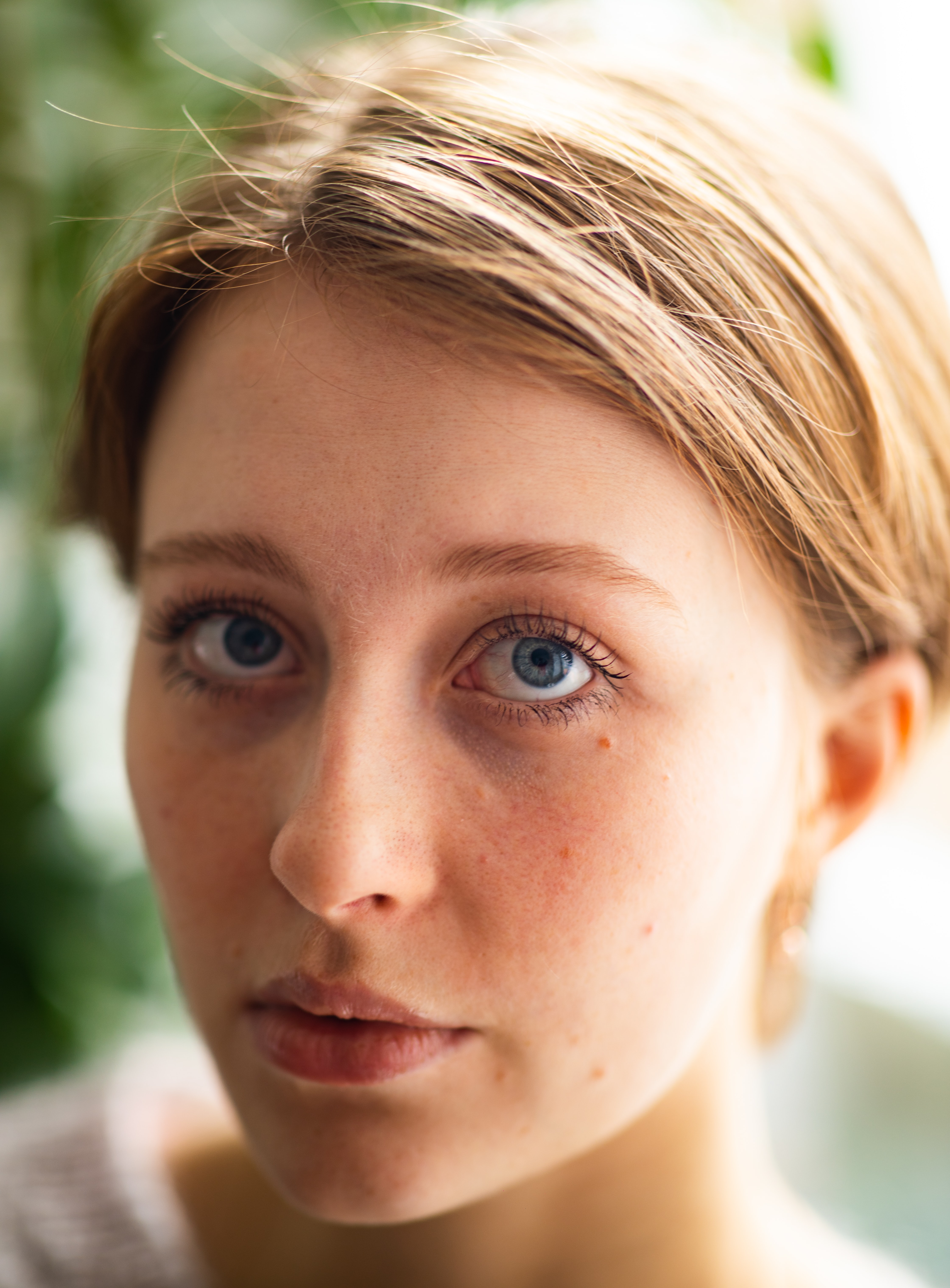 여드름이 난 소녀-여드름 원인