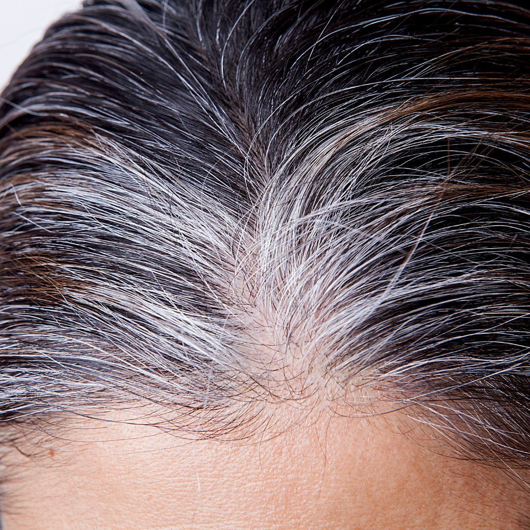 흰머리 나는 이유와 관리 방법, 효과적인 해결책