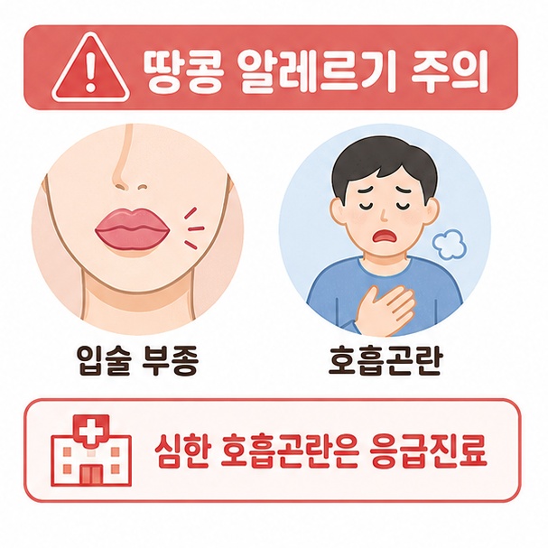 땅콩 알레르기로 입술 부종이나 호흡곤란이 나타날 수 있어 주의해야 함을 안내한 이미지