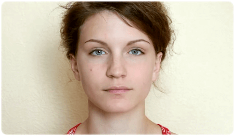 눈꺼풀 처짐 운동