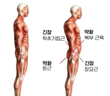 전방경사