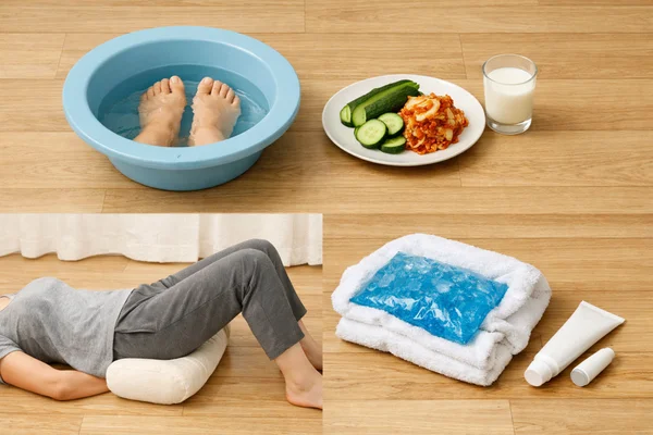 치질 초기 보존적 치료