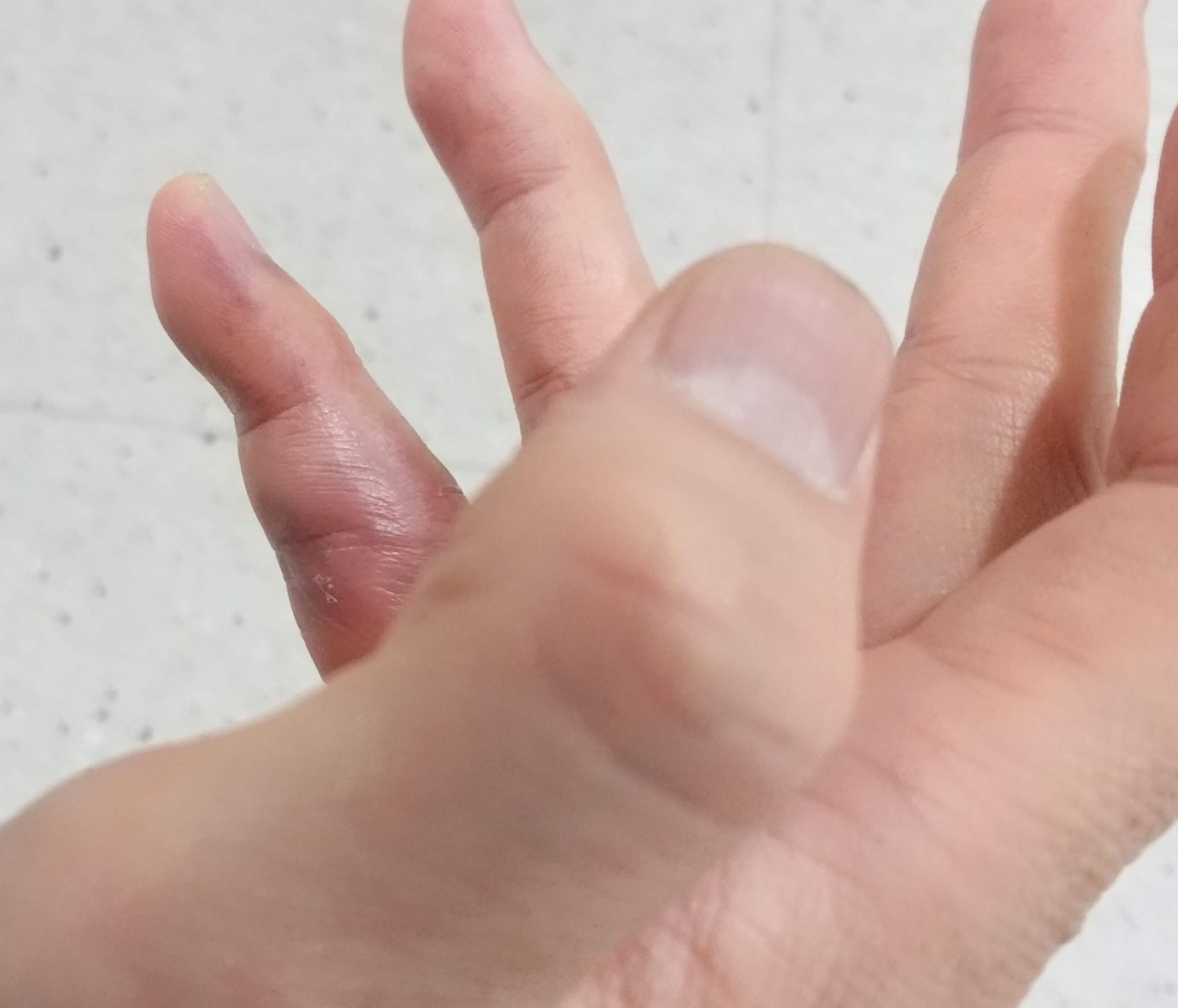 2월8일부은손가락사진2