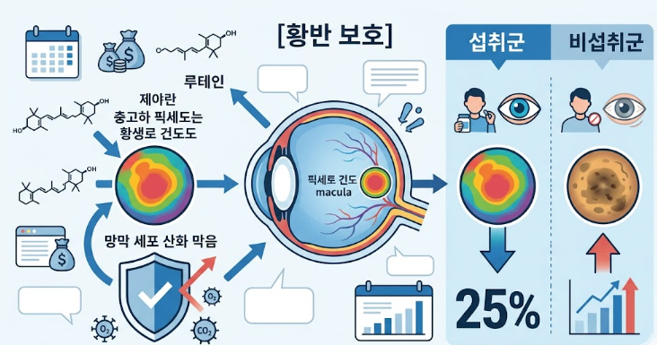 실명 질환 '황반변성' 예방의 핵심