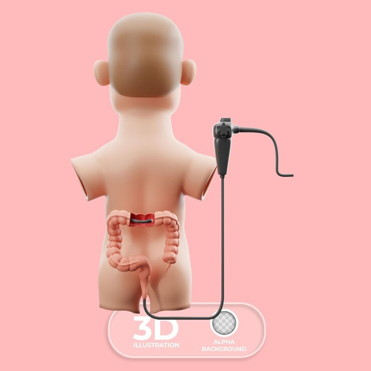 대장내시경 전 음식주의사항