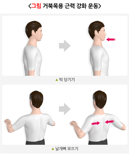 거북목용 근력 강화 운동