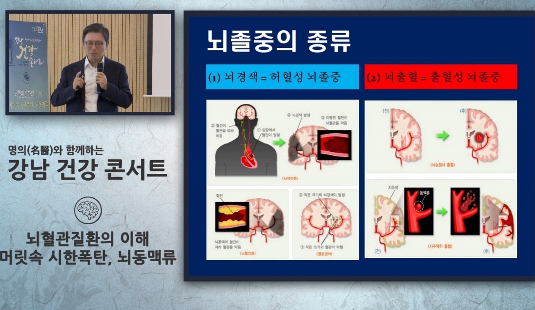 EBS-명의-뇌동맥류-김용배-교수-신경외과-뇌출혈